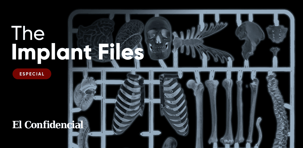 The Implant Files