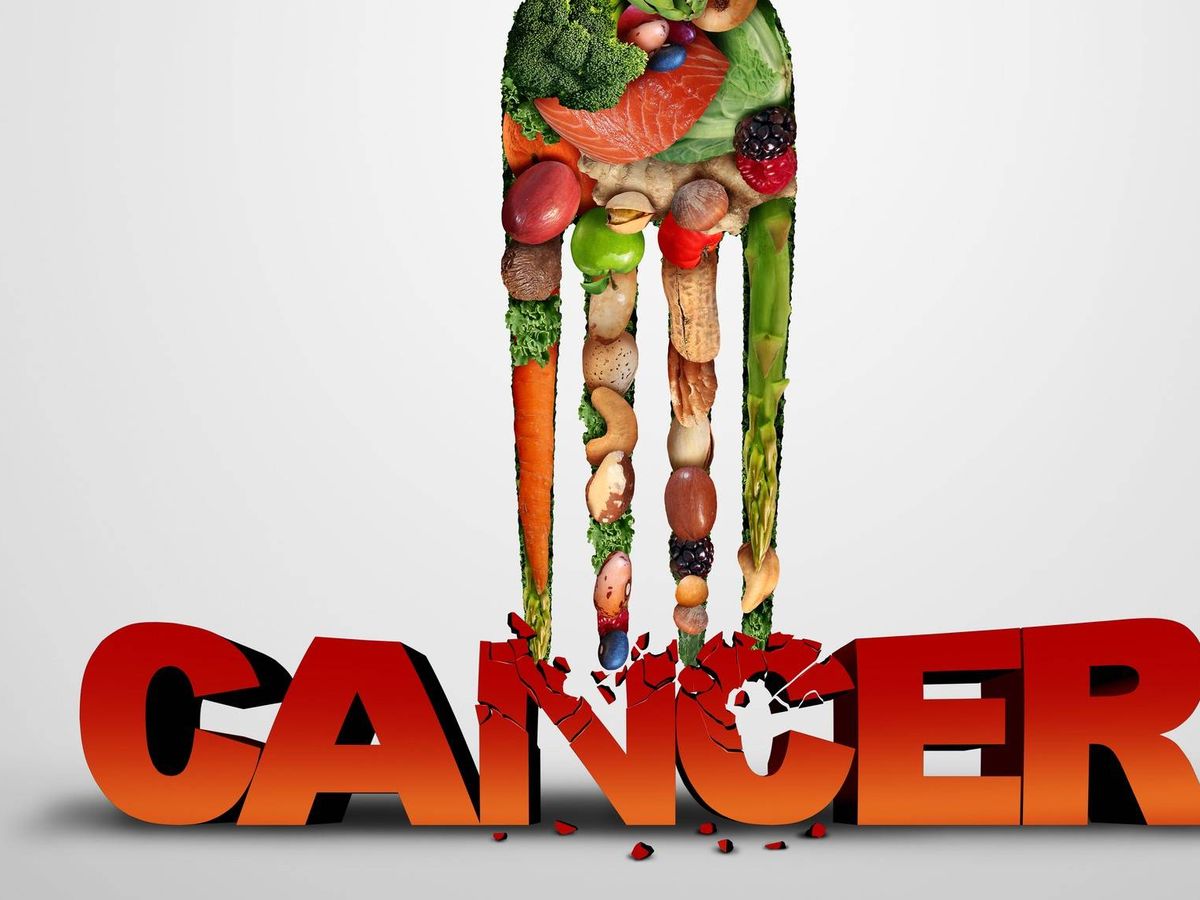 Alimentatia in cancer