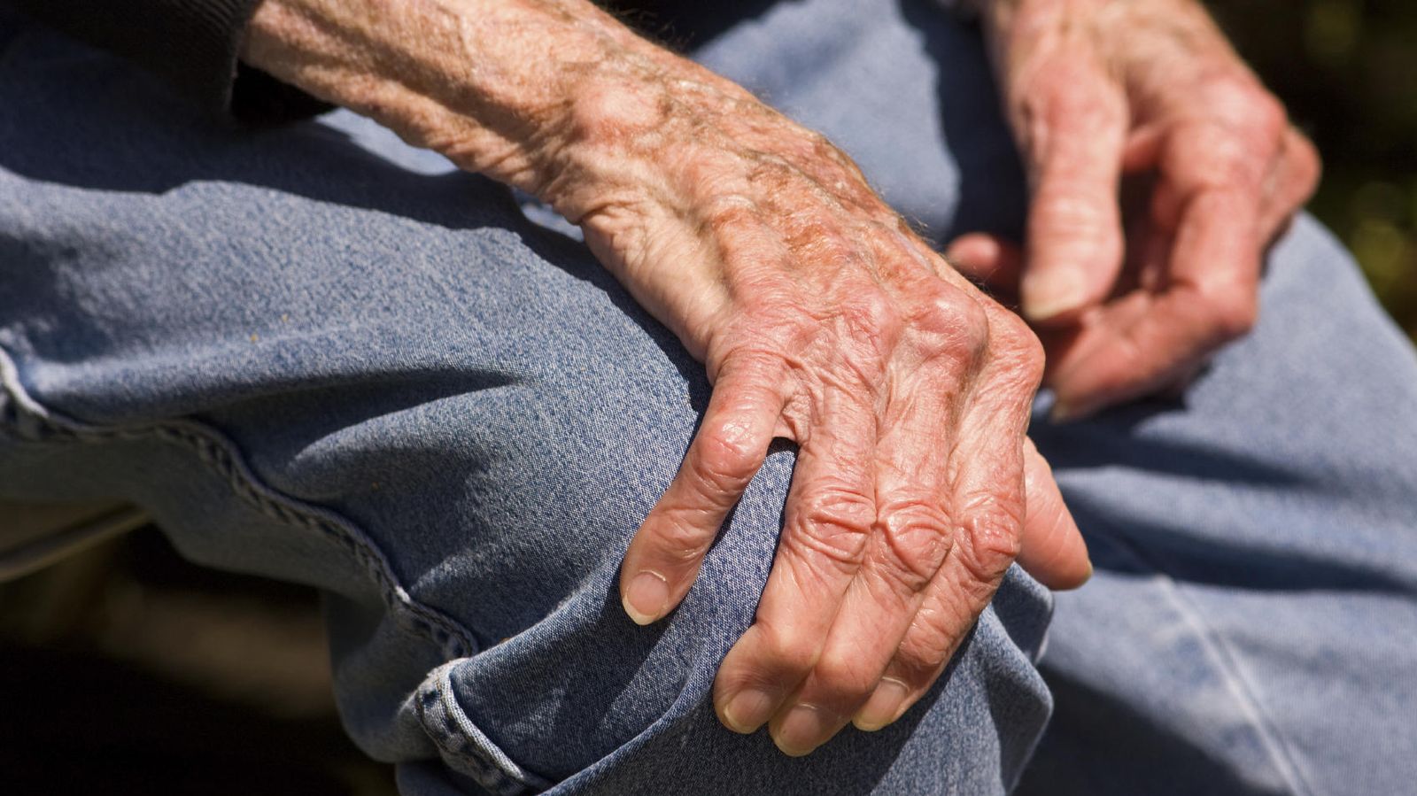 Pentru tratamentul la artroză la domiciliu Tratamentul artrozei genunchiului la domiciliu
