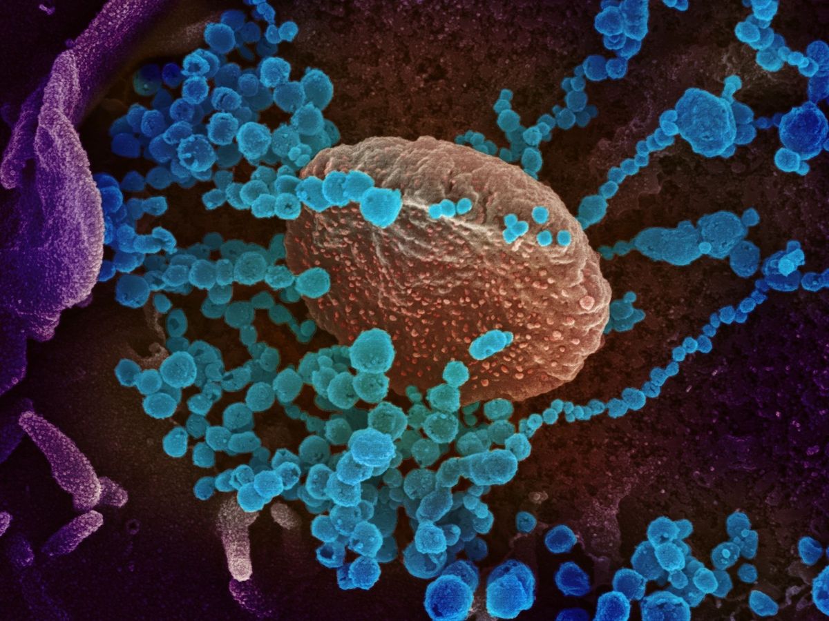 Foto: Imagen de microscopio electrónico que muestra en azul al SARS-CoV-2, el virus que causa el brote de covid-19. (EFE)