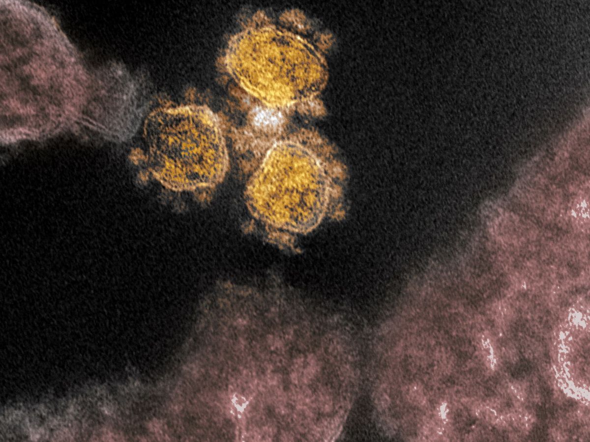Foto: Identifican una nueva cepa del virus que surgió en España y se está extendiendo por Europa
