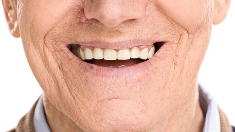 Desgaste dental: la factura de tu estilo de vida en tu boca