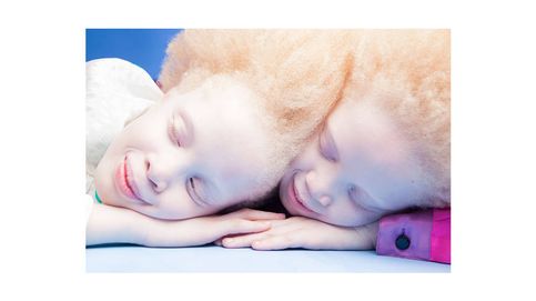 Lara y Mara Bawar, las gemelas albinas que se están rifando las marcas de moda