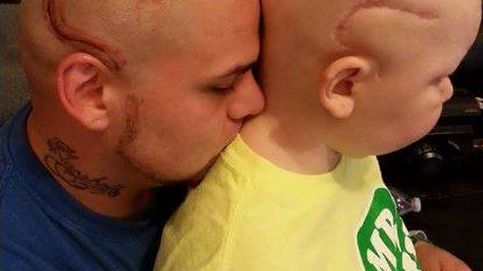 Un padre se tatúa en la cabeza la misma cicatriz que tiene su hijo, operado de cáncer