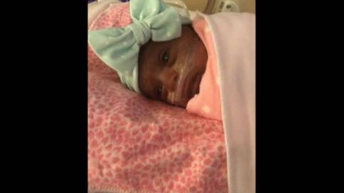 Saybie, la bebé superviviente más pequeña del mundo
