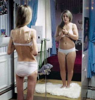 salir con alguien con anorexia nerviosa