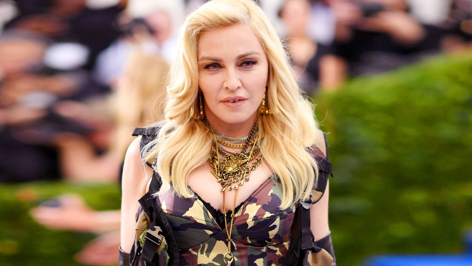 Cirugía estética: La deformación facial de Madonna: de los liftings a los  rellenos