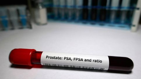 El coronavirus contra el cáncer de próstata  