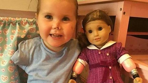 Esta niña no tiene ni brazos ni piernas: le regalan una muñeca igual a ella y explota de alegría