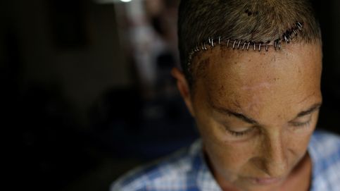 Los heridos de Maduro: Merece la pena luchar