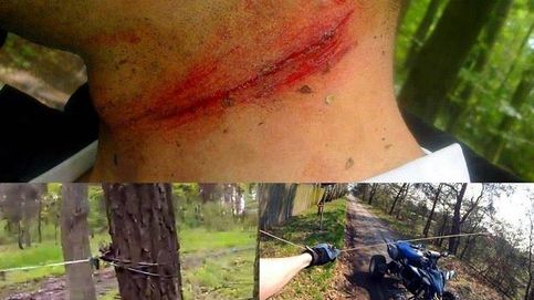 Las trampas para ciclistas: del cable a la altura del cuello al clavo para la bicicleta