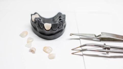 La evolución de las carillas dentales: qué son y para qué sirven