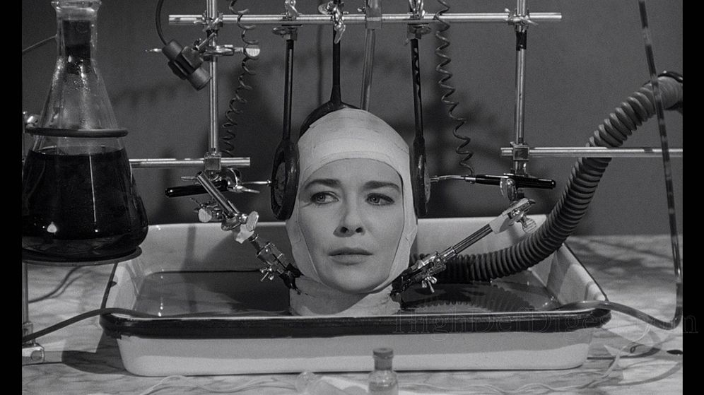 Foto: Fotograma de la película de 1962 'El cerebro que no quería morir'
