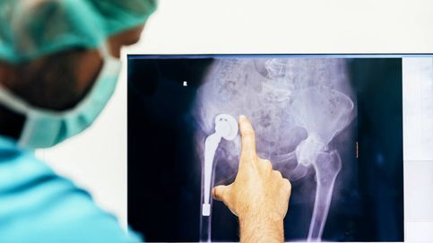 Todo lo que necesitas saber sobre la cirugía de prótesis de cadera