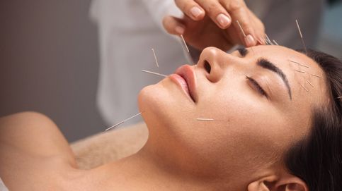 Algo huele a podrido en Pekín: ¿puede la acupuntura reducir los dolores de cabeza? 