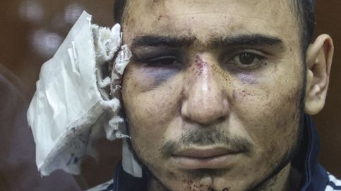 Estas son las sorprendentes imágenes de los terroristas del atentado en Rusia: sin oreja, en sillas de ruedas y con el rostro desfigurado