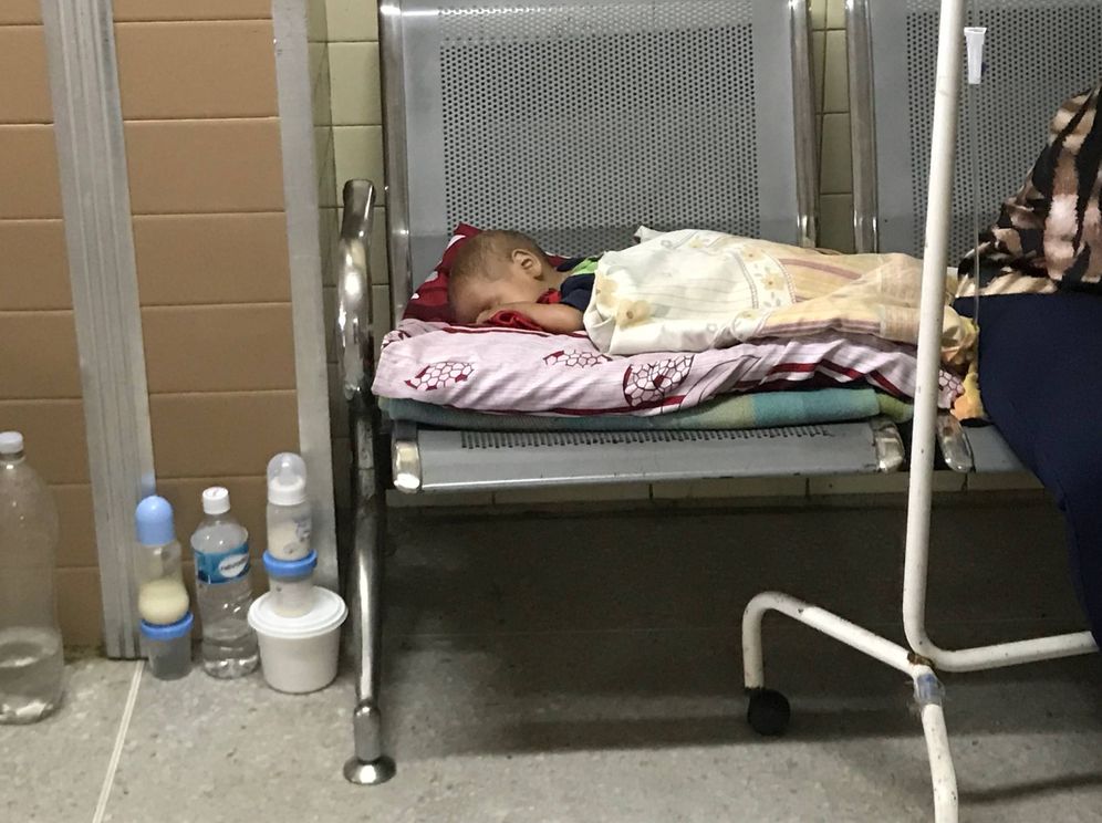 ¿Qué está pasando en Venezuela? Un-nino-muerto-al-dia-las-victimas-de-la-desnutricion-en-el-interior-de-venezuela