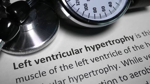 ¿Qué hacer si te han diagnosticado hipertrofia ventricular izquierda?