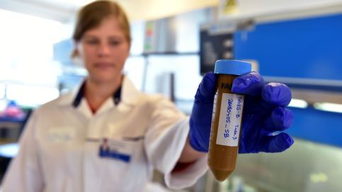 Esta universidad belga busca donantes de caca para ayudar a sus enfermos