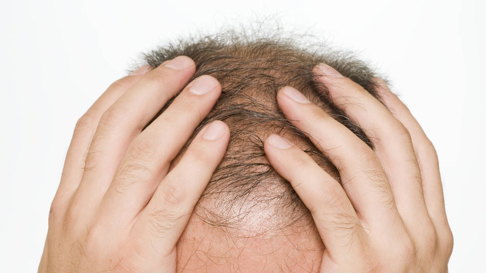 ¿Se te ha caído el pelo más de lo normal? Los efectos de 2020 en la salud de tu cabello thumbnail