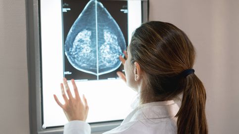 Un análisis de sangre detecta el cáncer de mama dos años antes de que aparezca
