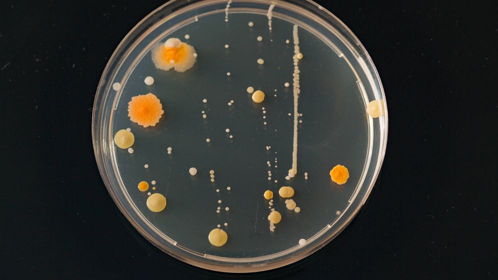 Foto: Miles de bacterias en una placa de petri. iStock