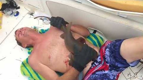Un tiburón nodriza muerde en el estómago a un hombre en Florida: “Tuve que agarrarlo, pensé que me iba a ahogar”