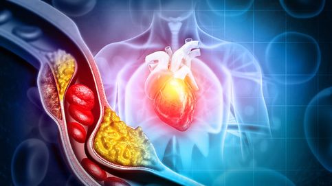 Niveles de colesterol y prevención de infarto: todos los últimos datos