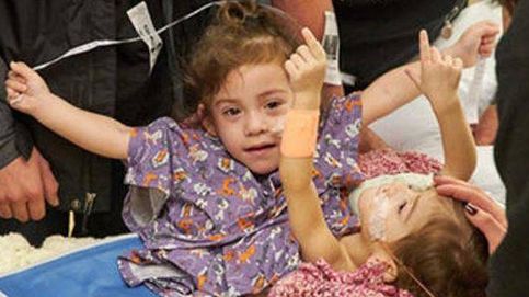 Separan a dos hermanas siamesas de California tras 17 horas de operación