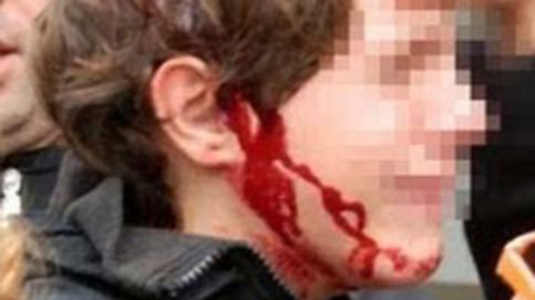 Los Mossos d'Esquadra cargan contra un niño de 13 años en Tarragona