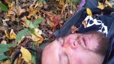 Sufre un accidente de moto y se despide de su familia en vídeo pensando que iba a morir