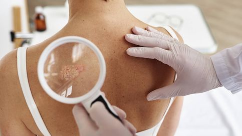 Las 6 verdaderas razones por las que los MIR eligen dermatología, explicadas por un dermatólogo