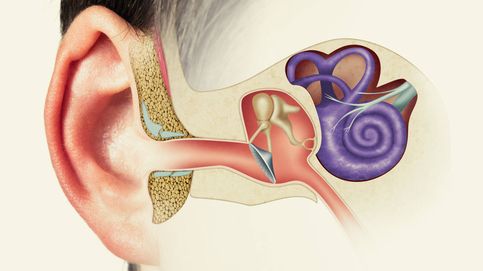 Oídos taponados: causas, cómo evitarlo y qué debes hacer y qué no para solucionarlo